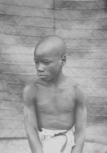 Disease photograph - Infection clinic - Dar-es-Salaam - Walther